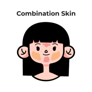 Skin Types 