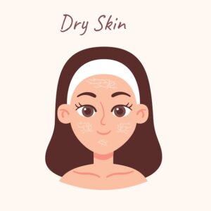 Skin Types 